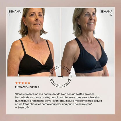 Busto Firme y Levantado Naturalmente - Sin Cirugía ni Pastillas